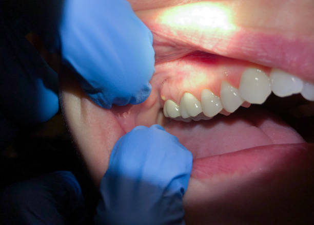 Best Emergency Dentist for Special Needs Patients in Sandy Springs, SC