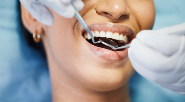 Best Emergency Cosmetic Dentistry in Sandy Springs, SC