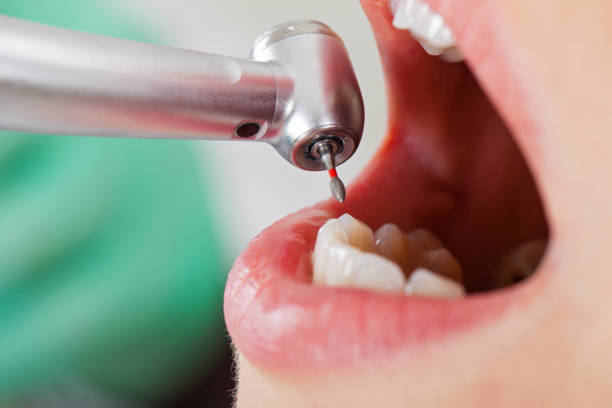 Best Weekend Emergency Dentist in Sandy Springs, SC